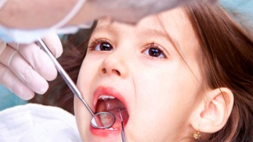 Nguyên nhân răng mọc lệch và các phương pháp chỉnh răng cho trẻ